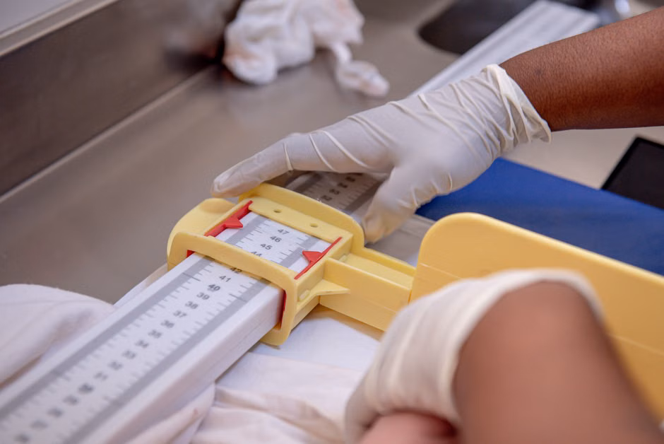 Close-up of a healthcare professional measuring an infant using a medical ruler.